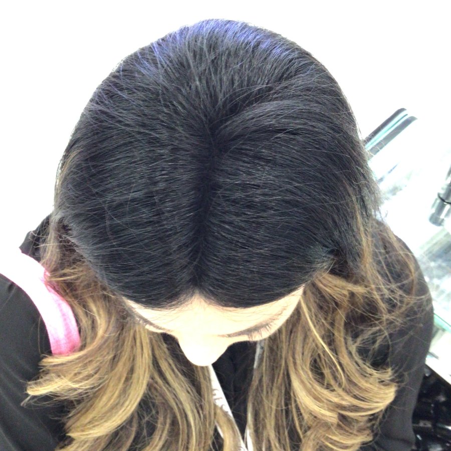 Crown after root coverage
