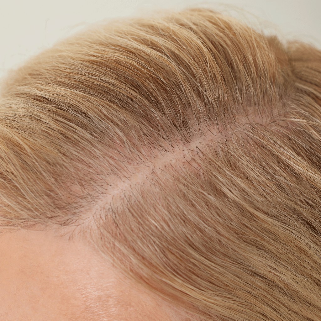 Hair Thickening Fibers before application