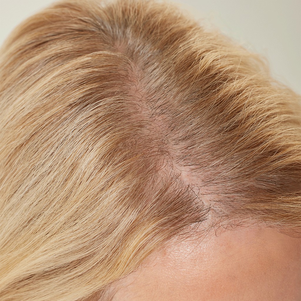 Hairline Powder before application
